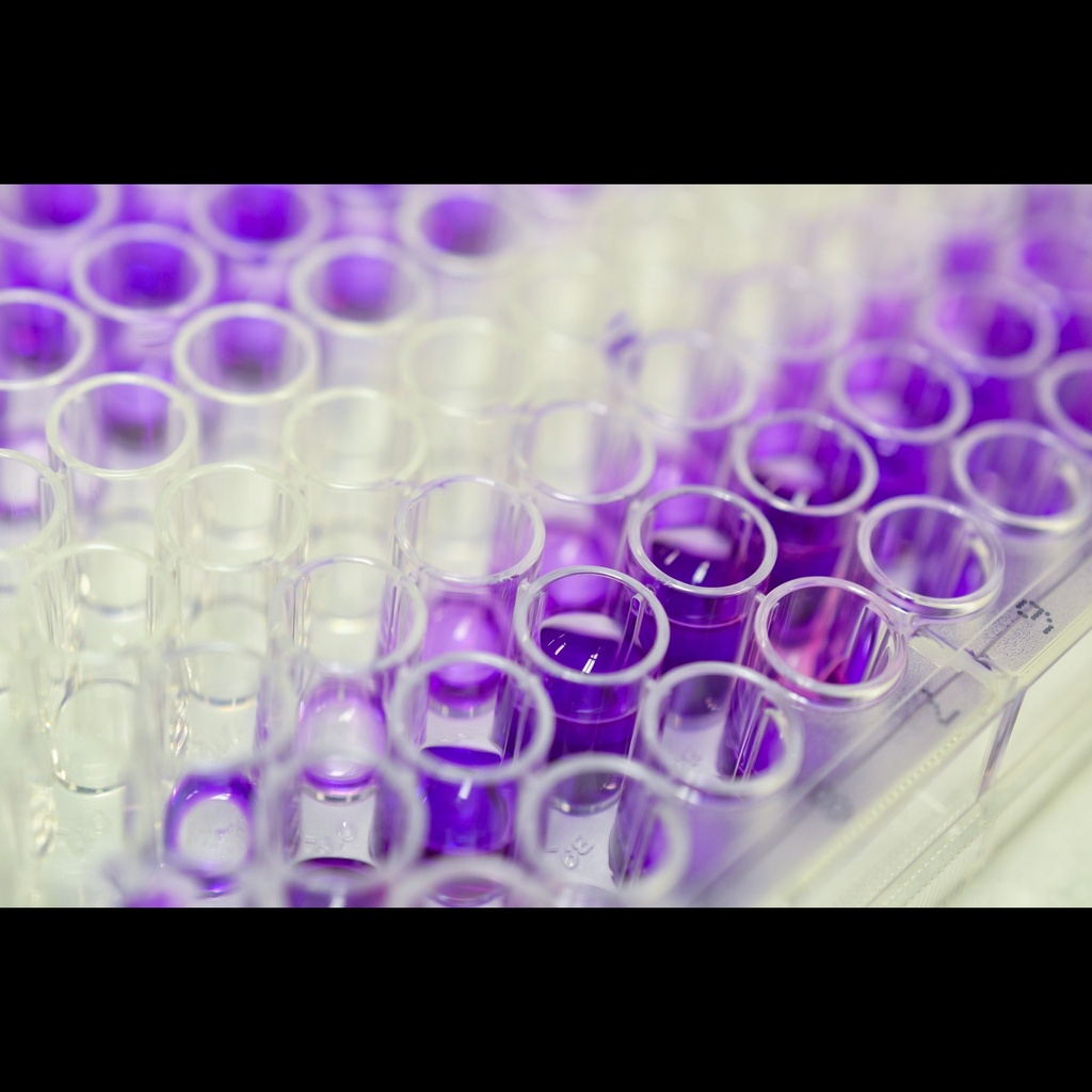 Horse Crosssize:Linked Csize:Terminal Telopeptides of Type II Collagen ELISA Kit, 96 test